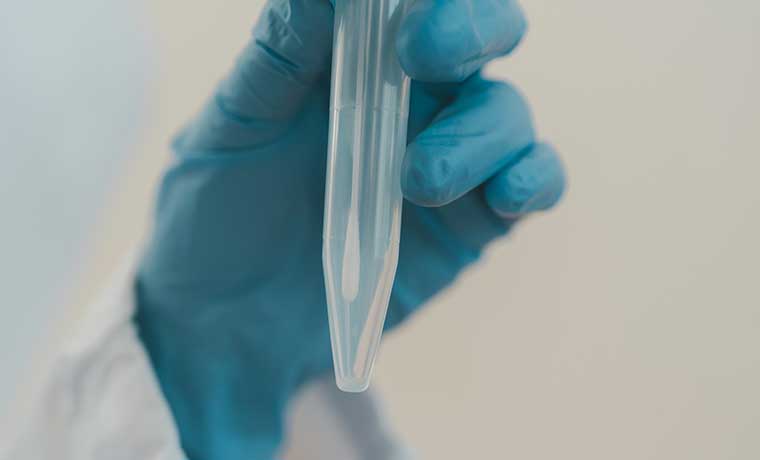 検査サービス提供企業様向け検体輸送・回収支援